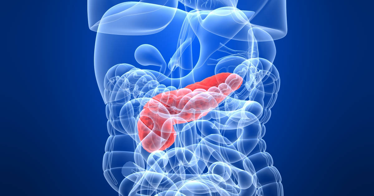 Pancreatic Cancer
